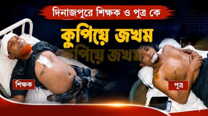 ফুলবাড়ীতে(বেতদিঘী ইউনিয়নের সিদ্দিশী গ্রামে) গাছের ক্ষতিপূরণ নিয়ে সংঘর্ষ, পিতা-পুত্র আহত